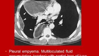 Whole Body Computed Tomography Pleura video book lecture