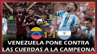 ​ ¡VENEZUELA MERECE MÁS ANTE ARGENTINA! ​