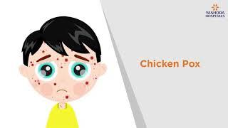 Chicken Pox: Symptoms, Causes, Prevention and Treatment | Yashoda Hospitals