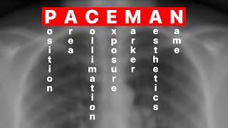 PACEMAN Image Evaluation Criteria: Explained!