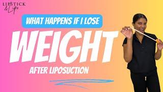 What happens to my liposuction results if I lose weight?