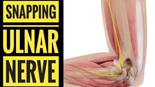 Elbow Clicking due to Snapping Ulnar Nerve