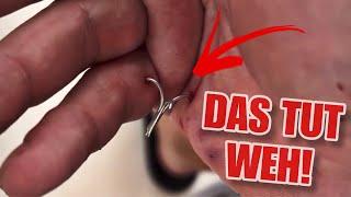 MEGA FAIL! Angelhaken aus der Hand lösen mit diesem Trick!