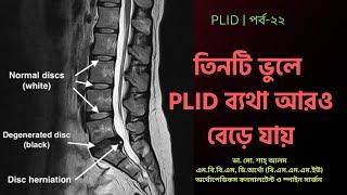 PLID 22 | তিনটি ভুলে PLID ব্যথা আরও বেড়ে যায় | 3 Mistakes More PLID Pain | Doctor Shah Alam