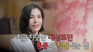 지긋지긋한 대상포진 통증과 작별하는 법 | 신경통 | 명의 | #EBS건강