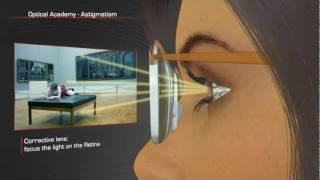 Shamir Optical Academy Astigmatism