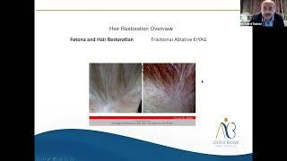 Clarion-Dr. Ashraf Badawi-Laser Assisted Hair restoration, a novel approach