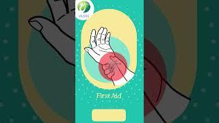 ️ First Aid Treatment for Skin Burn #shorts