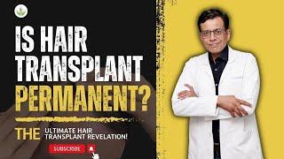 Is Hair Transplant Surgery Permanent? - Dr. Sandeep Bhasin | Care Well Medical Centre