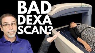 Osteoporosis  Worries? (True Stories of Real Women)