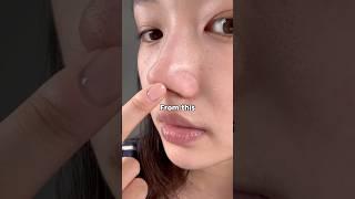 I Tried Korean Blackhead Removal and Got SHOCKING Results! 