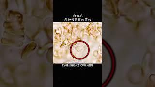 来看白细胞是如何灭掉寄生虫的 #科普 #知墨探索 #冷知识