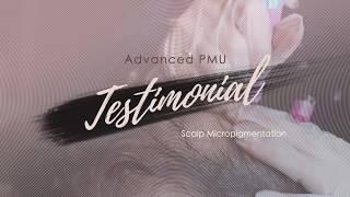 Patrick's Scalp Micropigmentation Testimonial | Advanced PMU