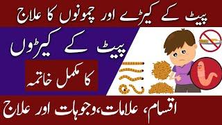 STOMACH WORMS | PAIT KE KEERO KA ELAJ | CHAMOONAY | PINWORMS | Hakeem Malik Ahmad Farooq