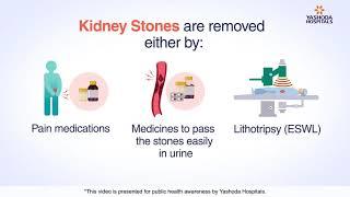 Kidney Stone Removal | Kidney Stone: Causes, Signs, and Treatment Methods