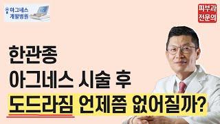 한관종  아그네스 시술 후 도드라짐은 언제까지 지속될까