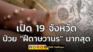 กรมควบคุมโรคเปิด 19 จังหวัด พบป่วย "ฝีดาษวานร" มากสุด กทม.-นนท์-ชลบุรี น่าห่วง!