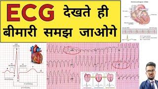 ECG Report | ECG Report Reading | ECG Report kaise Pade | Doctor | Hospital | Nursing | BHMS | BAMS