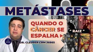 [ METÁSTASES:  É Possível a Cura Quando o Câncer se Espalha?