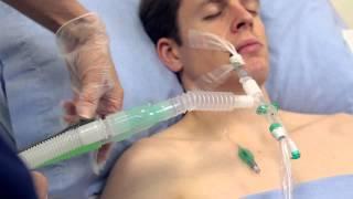 Using Intersurgical's TrachSeal™ closed suction systems