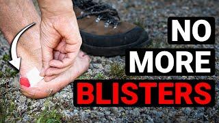 How to Avoid Getting Blisters from Hiking