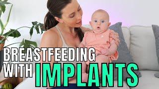 Breastfeeding with Implants is Possible and Here's How!