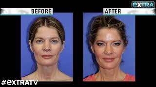 Emmy-winning Actress Michelle Stafford's Secret to Looking Younger without Surgery: Forma