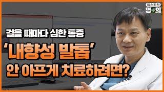 [내향성발톱 명의] 시술 5분이면 통증 완화…자가치료보다 효과적