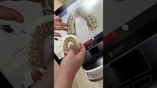 3D сканирование зубов