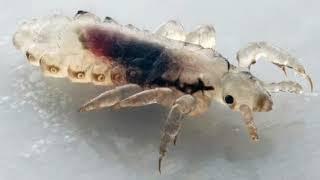 Best Lice Infestations on YouTube 15 Lousy Lice Facts