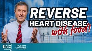 Foods That Reverse Heart Disease | Dr. Neal Barnard Live Q&A