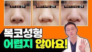 복코마다 다른 수술방법이 있다? 사례자를 통해 알아보자! [히트성형외과 l hit plastic surgery]