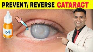 Prevent / Reverse Cataract Naturally | 2 Best Ayurvedic Remedies..... Cataract