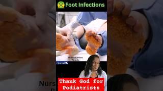  Foot Infections & Toe Jam | Nurse Eunice Reacts #FootFungus #AthletesFoot