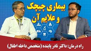 راه درمان: بیماری چیچک و علایم آن- داکتر نادر پاینده (متخصص داخله اطفال)