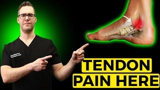 Posterior Tibial Tendonitis Treatment [Inside of the Ankle Pain]