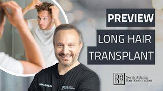 See YOUR Hair Transplant Results Instantly