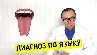 ЯЗЫК покажет что не так со здоровьем!