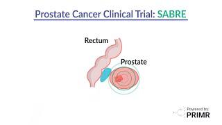 Prostate Cancer Clinical Trial: SABRE Trial