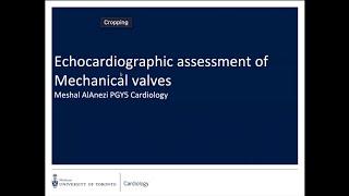 Title:  Echocardiographic Assessment of Mechanical Valves