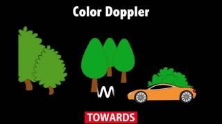 Ultrasound Physics Scanning Modes Color Doppler