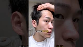 종류별 여드름 흉터 관리법
