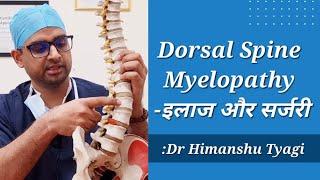 Dorsal Spine Myelopathy क्या होती है ?(इलाज और सर्जरी). Compressive dorsal Myelopathy.