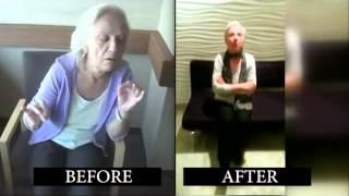 Ali Zırh, MD.Neurosurgeon Testimonial-Before and after Deep Brain Stimulation /Parkinson Disease
