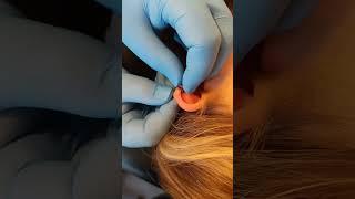 Helix Piercing using BVLA Mini Fern  Pierced by Jabba @get-piercedltd Carlisle, Cumbria 