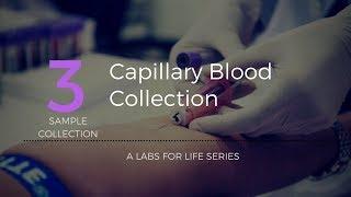 Capillary Blood Collection