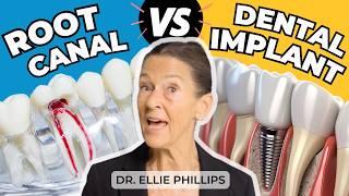 Root Canals vs Dental Implants: Which is Better for You?