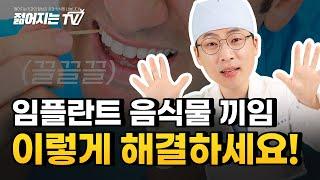 [젊어지는치과] 임플란트에 음식물이 낀다? 해결 가능합니다!