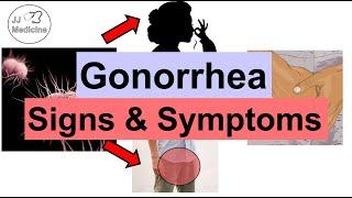 Gonorrhea Signs and Symptoms & Complications (& Why They Occur)