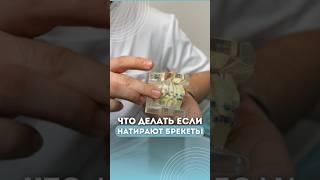 Что делать, если натирают брекеты?  #стоматологмосква #ортодонтмосква